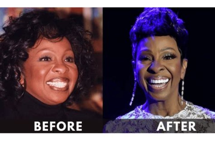 Gladys Knight Weight Loss 2023 : Inspiring Before & After Photo - SarkariResult